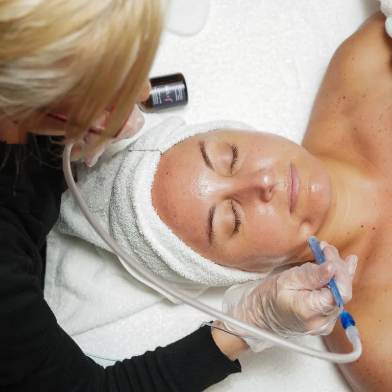 Jetpeel facial